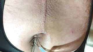 Injecting anus with procaine