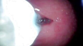 The camera in the penis shows the best picture of the male orgasm event