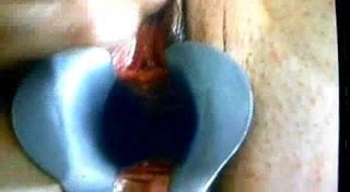 crazy gyno doc part 1