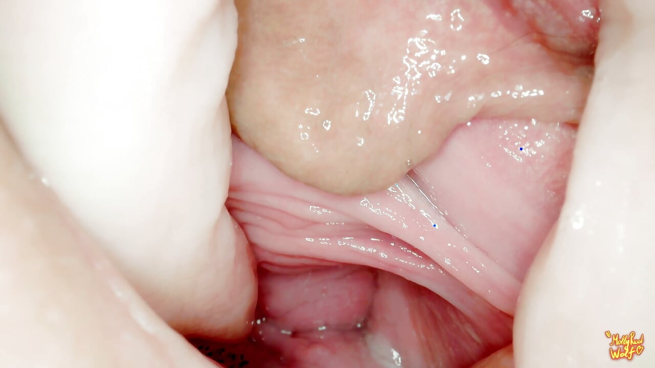 Hey Stepbrother! Let’s Play Gynecologist? Gyno, Endoscopy – Mollyredwolf